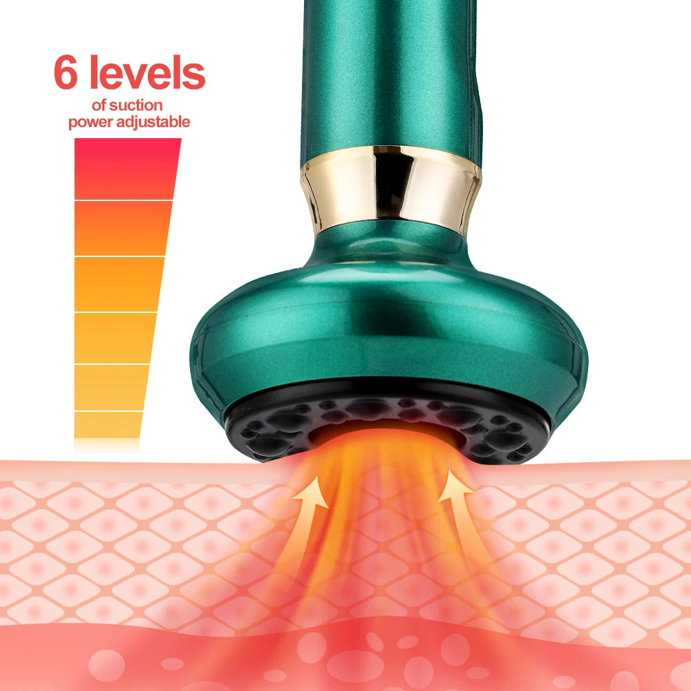 Cupping Therapy Massager